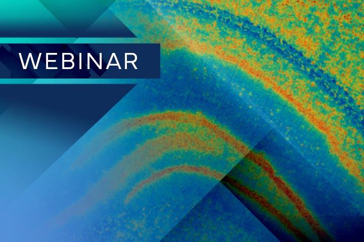 Multi-OmicsOvarian-Cancer-Webinar