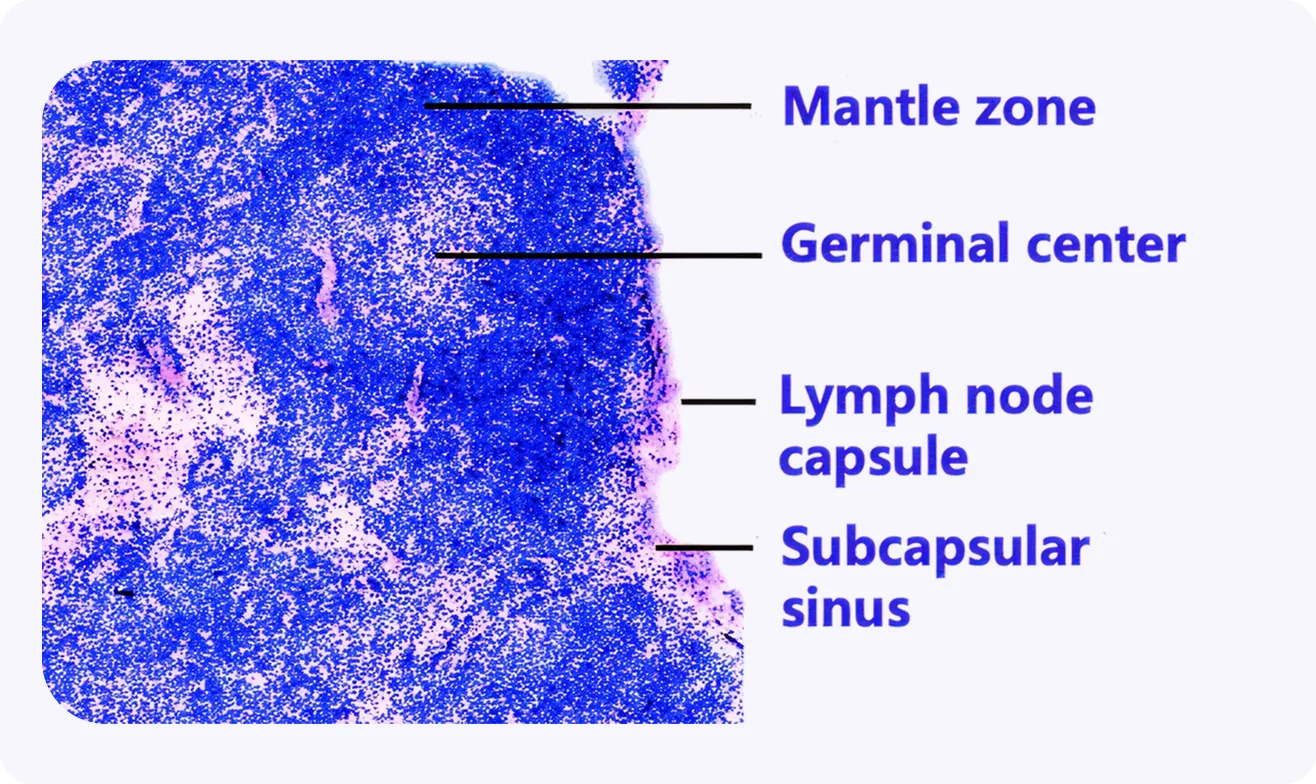 Stereo_CITE_pathology_annotations